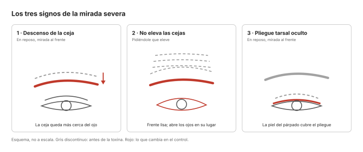 Los 3 signos de mirada severa
